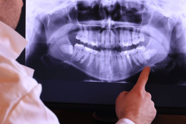 Best Emergency Dental Care for Broken or Chipped Teeth in Austell, GA